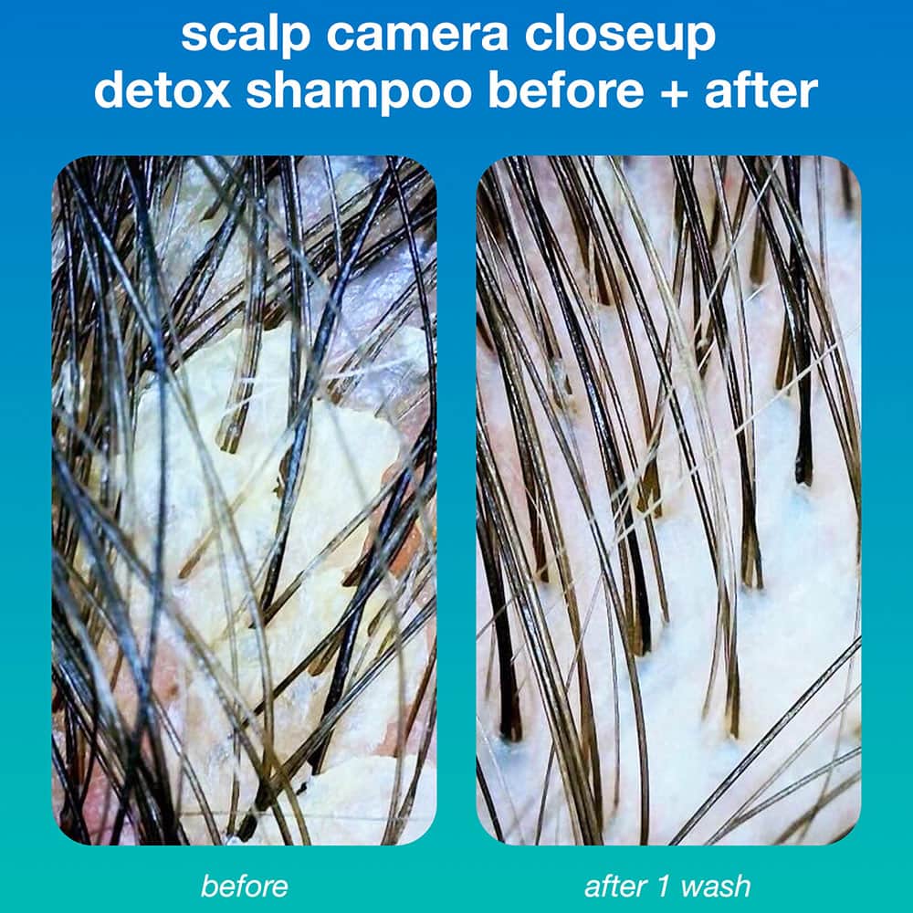 Detox before & after